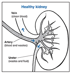 diabetes_healthy_kidney
