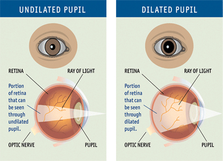 Eye Exam