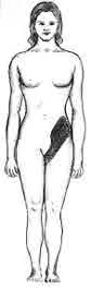 Kidney Stone Pain Front