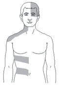 Shingles Rash Location