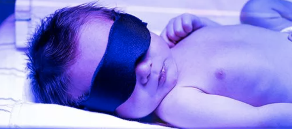 Photo of infant receiving phototherapy 