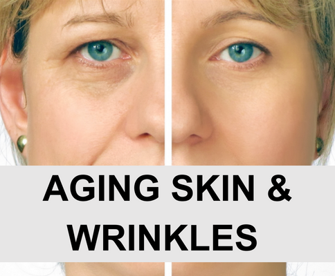 Aging Skin & Wrinkles