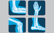 Bone and Joint
