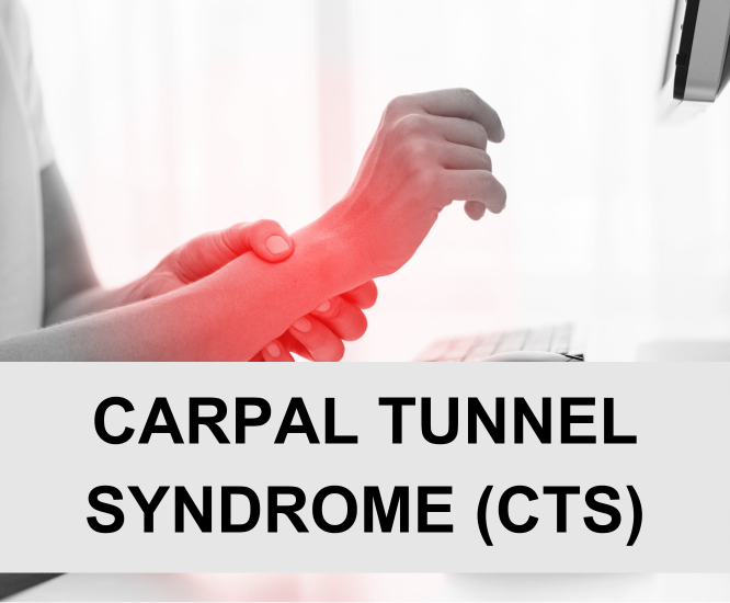 Carpal Tunnel Syndrome (CTS)