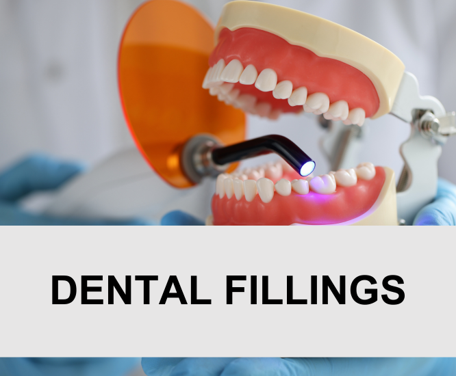 Dental Fillings