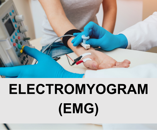 Electromyogram (EMG)