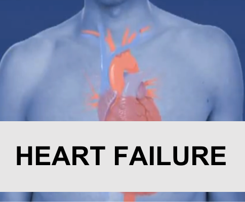 Heart Failure (CHF)