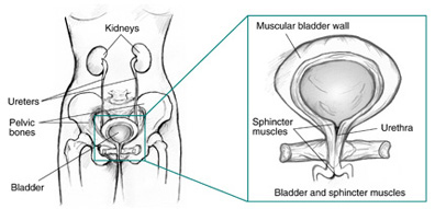 Urinary Incontinence