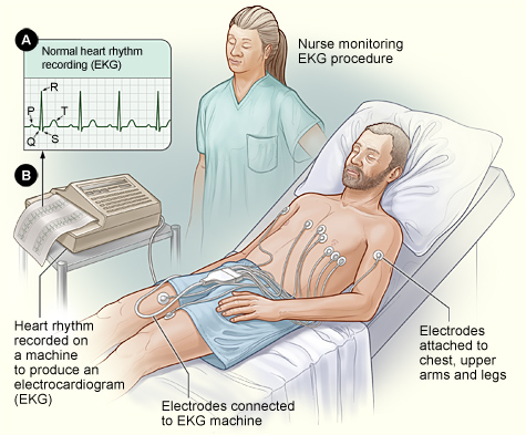 electrocardiogram_ECG.jpg