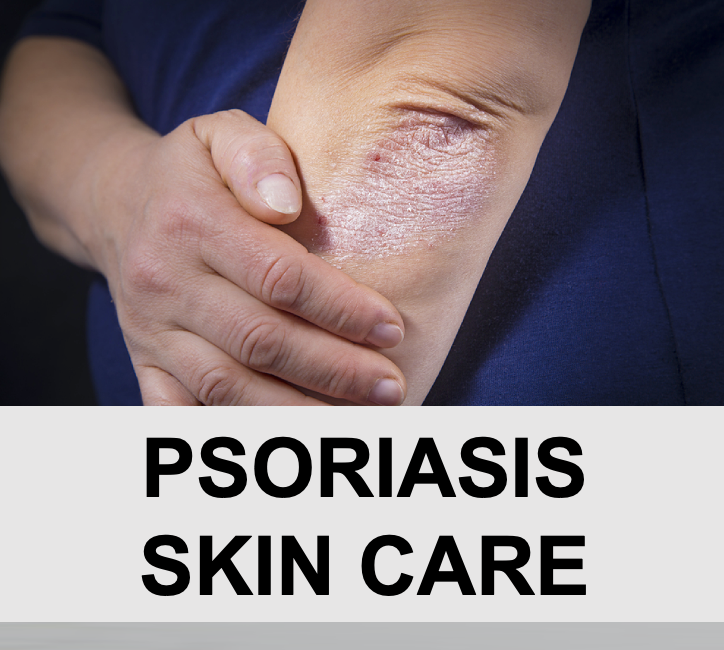 Psoriasis Skin Care Tips